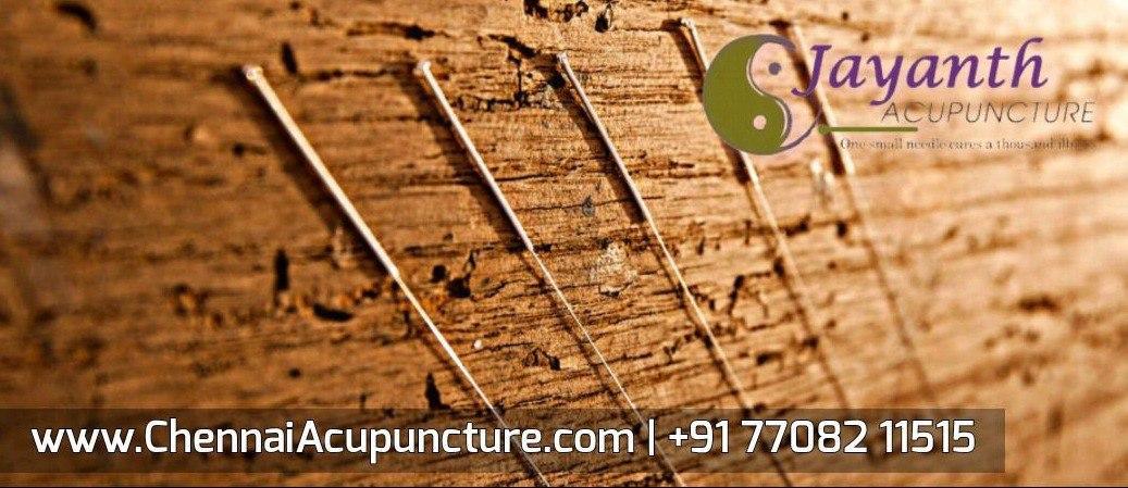 Jayanth Acupuncture Clinic- Anna Nagar